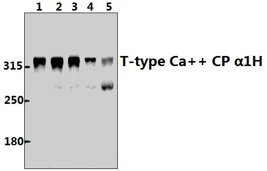 T~type Ca++ CP α1H (P492)