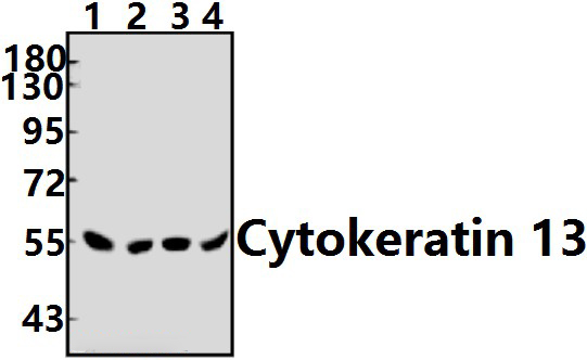 Cytokeratin 13 (E282)