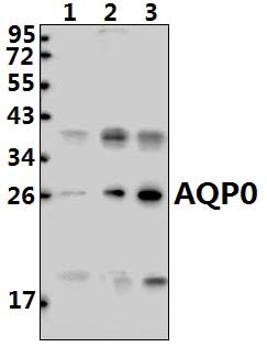 AQP0 (C144)