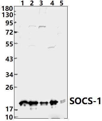 SOCS~1 (V98)
