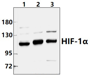 HIF~1α (K377)