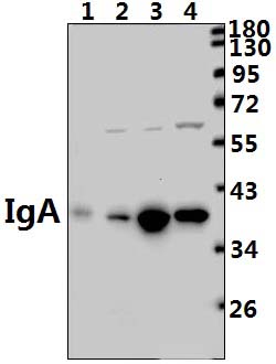 IgA (Y276)