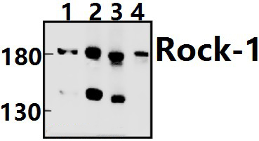 Rock~1 (N311)