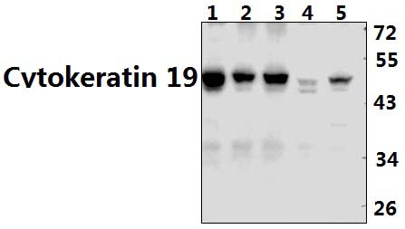 Cytokeratin 19 (L349)