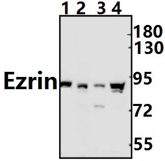 Ezrin (G560)