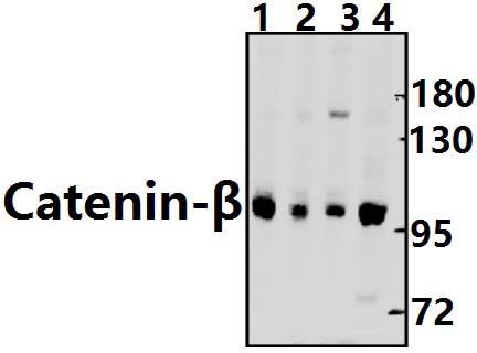 Catenin~β (Q27)
