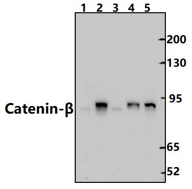 Catenin~β (Y30)