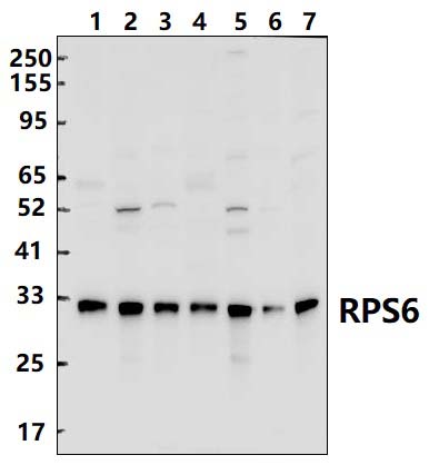 S6 Ribosomal Protein (RPS6)