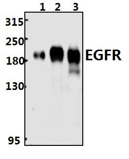 EGFR (S1104)