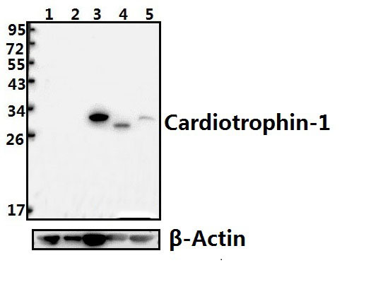 Cardiotrophin~1 (H31)