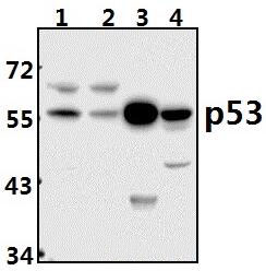 p53 (V31)