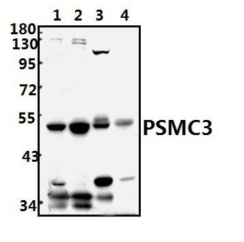 PSMC3 (V306)