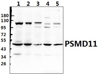 PSMD11 (R310)