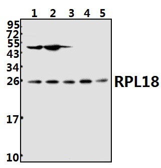 RPL18 (H151)
