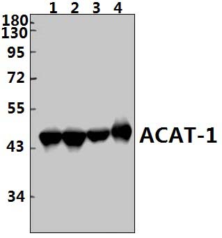 ACAT1 (K266)