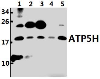 ATP5H (D146)