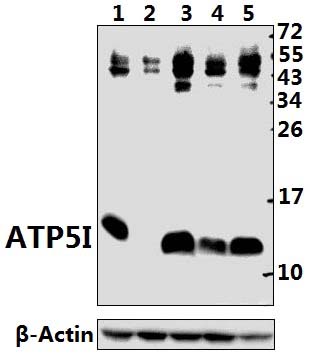 ATP5I (K69)