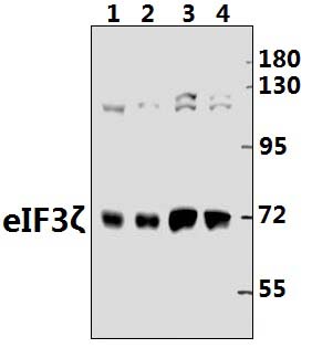 eIF3ζ (R135)