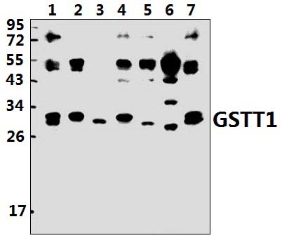 GSTT1 (R31)