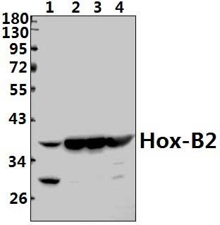 Hox~B2 (P67)