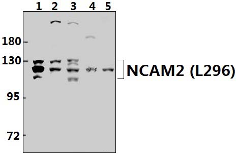 NCAM2 (L296)