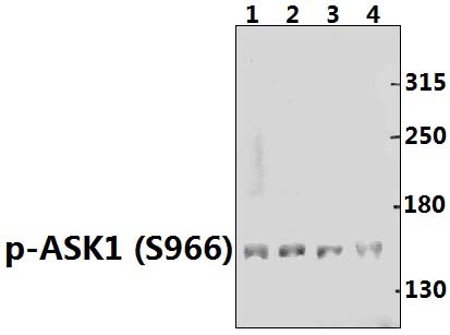 ASK1 (phospho~S966)