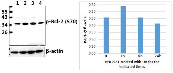 Bcl~2 (phospho~S70)