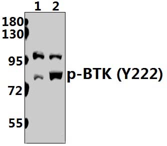 BTK (phospho~Y222)