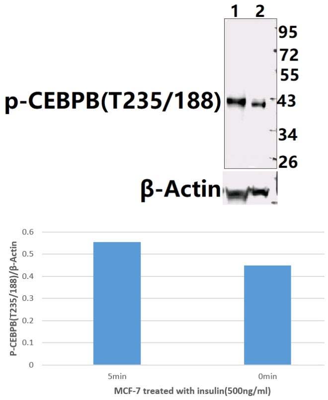 C/EBP~β (phospho~T235/188)