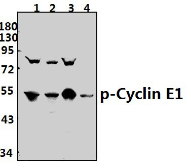 Cyclin E1 (phospho~T395)