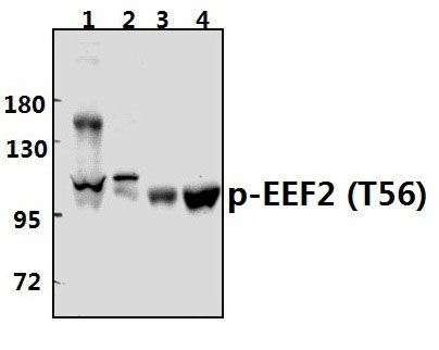 EEF2 (phospho~T56)