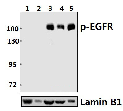 EGFR (phospho~S1046)