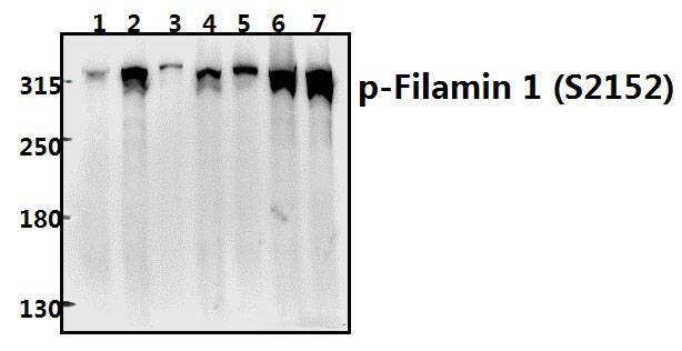 Filamin 1 (phospho~S2152)