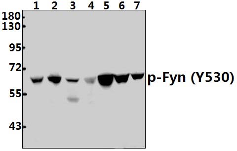 Fyn (phospho~Y530)