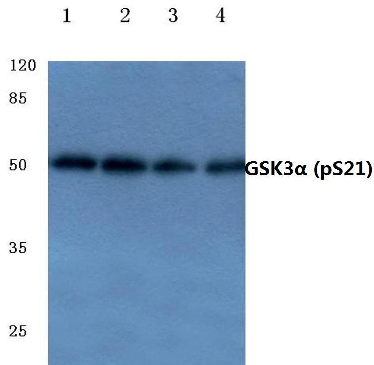 GSK3α (phospho~S21)
