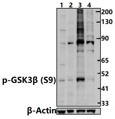 GSK3β (phospho~S9)