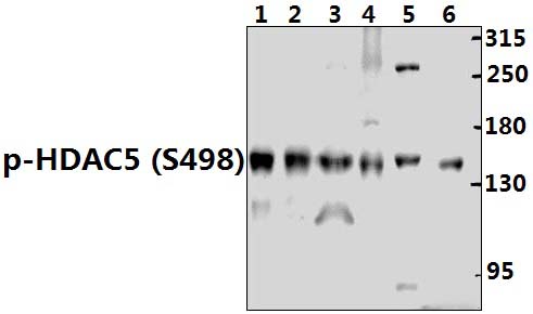 HDAC5 (phospho~S498)