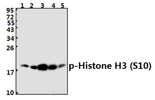 Histone H3 (phospho~S10)