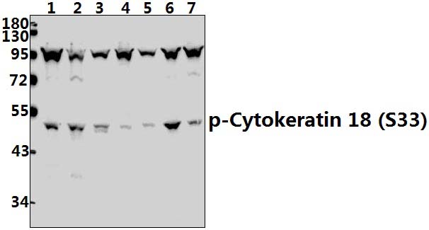 Cytokeratin 18 (phospho~S33)