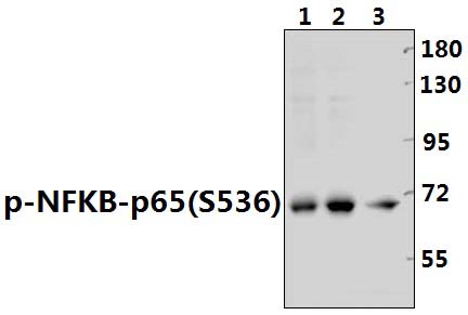 NFkB~p65 (phospho~S536)