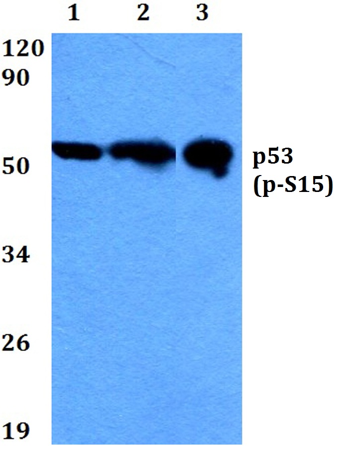 p53 (phospho~S15)