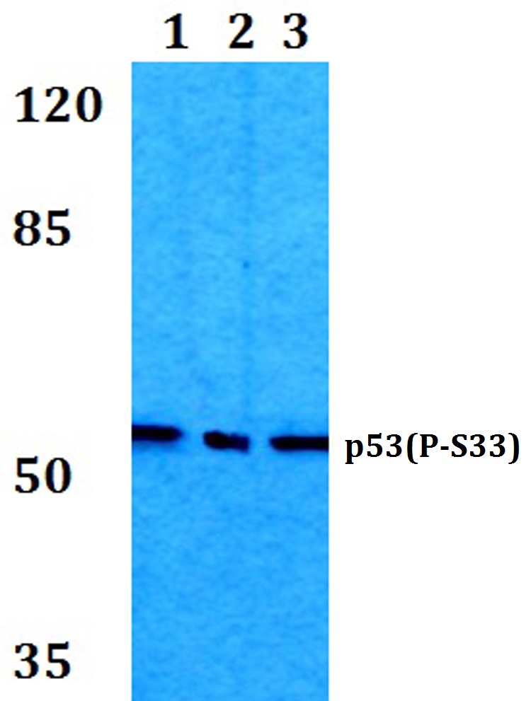 p53 (phospho~S33)