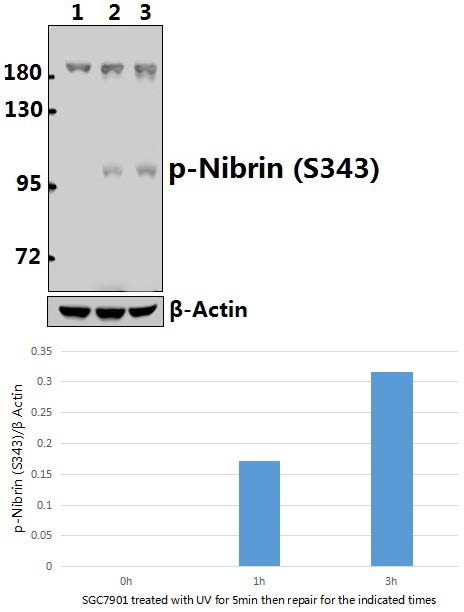 Nibrin (phospho~S343)