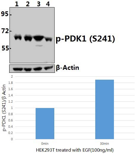 PDPK1 (phospho~S241)