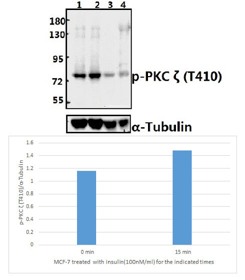 PKC ζ (phospho~T410)