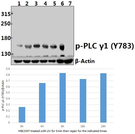 PLC γ1 (phospho~Y783)