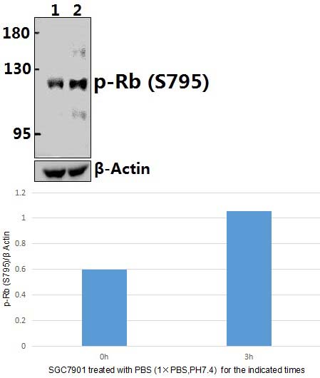 Rb (phospho~S795)