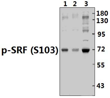 SRF (phospho~S103)