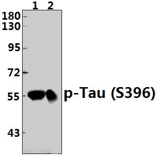Tau (phospho~S396)
