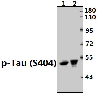 Tau (phospho~S404)